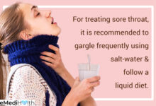 how to treat to treat sore throat