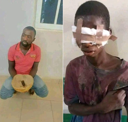 Man and his accomplices arrested for plucking out eyes of 16-year-old boy in Bauchi