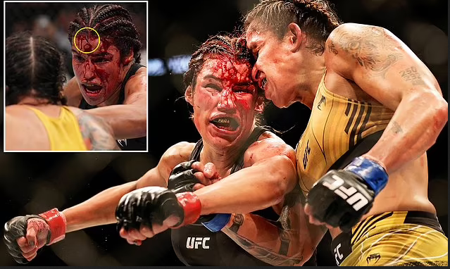 Female UFC fighter, Julianna Pena is rushed to hospital and taken to see a plastic surgeon after losing a 