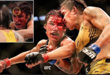Female UFC fighter, Julianna Pena is rushed to hospital and taken to see a plastic surgeon after losing a