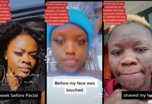 Nigerian model shares video showing how her face was damaged after she went for a facial